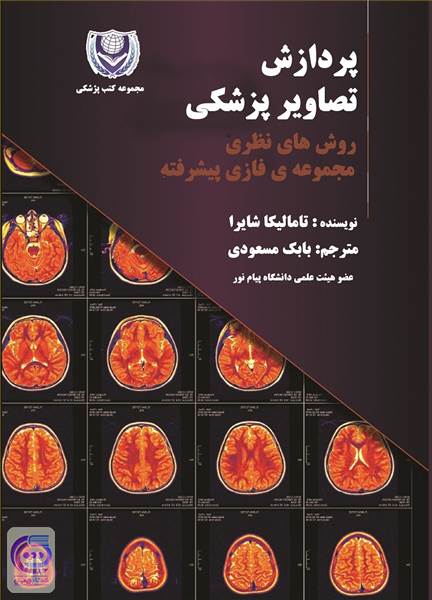 پردازش تصاویر پزشکی روش های نظری مجموعه ی فازی پیشرفته