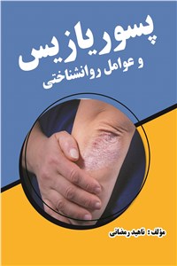 پسوریازیس و عوامل روانشناختی