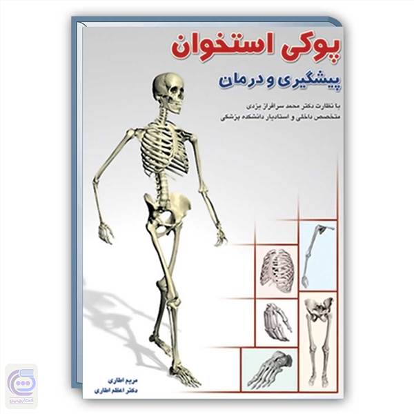 پوکی استخوان - پیشگیری و درمان