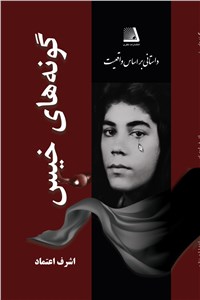 گونه های خیس